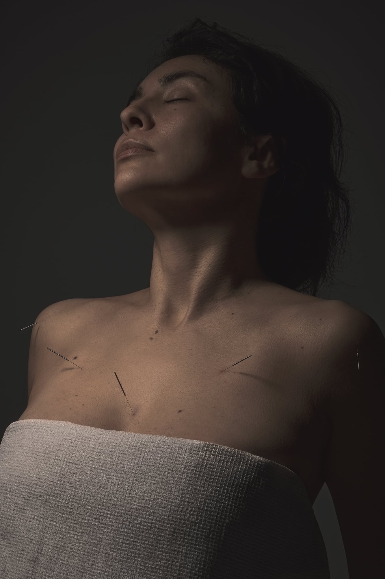 25-01-25_ZI-Accupuncture_0621